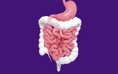 Cirurgia de intestino – melhor tratamento intestinal