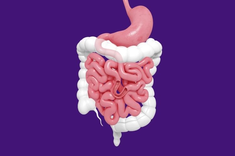 Cirurgia de intestino – melhor tratamento intestinal